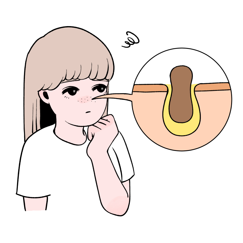 毛穴は隠さずなくしちゃえ スペシャルケア 撃退アイテムで 毛穴レスなちゅるちゅる肌をget Mismos ミスモス