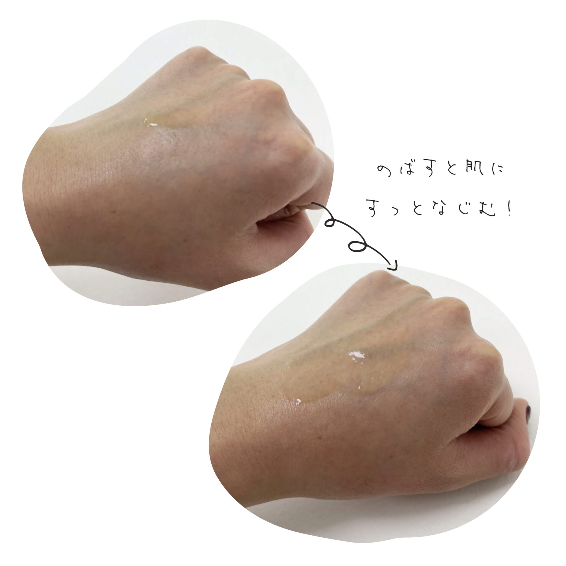 ミュゼコスメに入ってる成分「ミュフラ」って何？毛穴ケアにオススメな 
