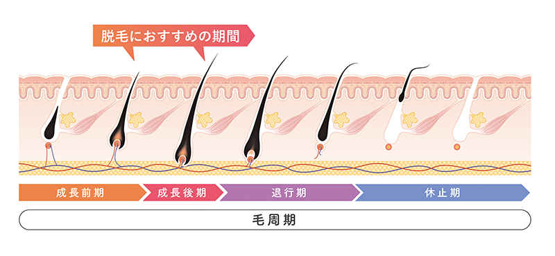 光脱毛の仕組みや効果って？医療脱毛との違いや料金について紹介 